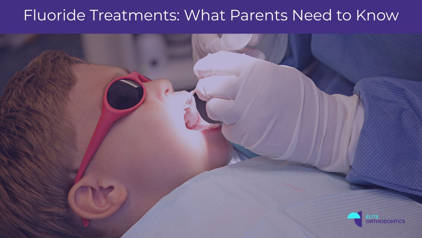 fluoride treatments for children