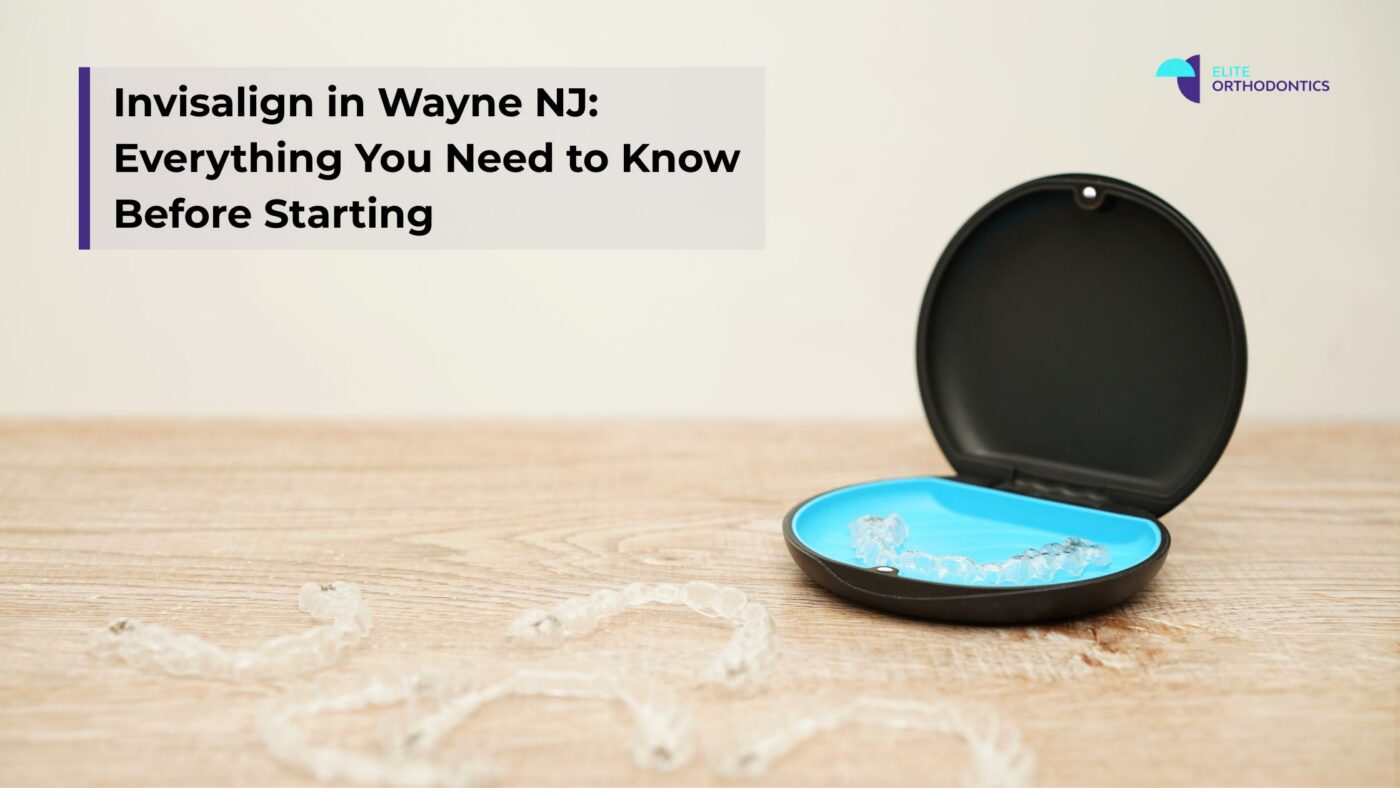 invisalign aligners on table with text: invisalign in wayne nj: everything you need to know before starting