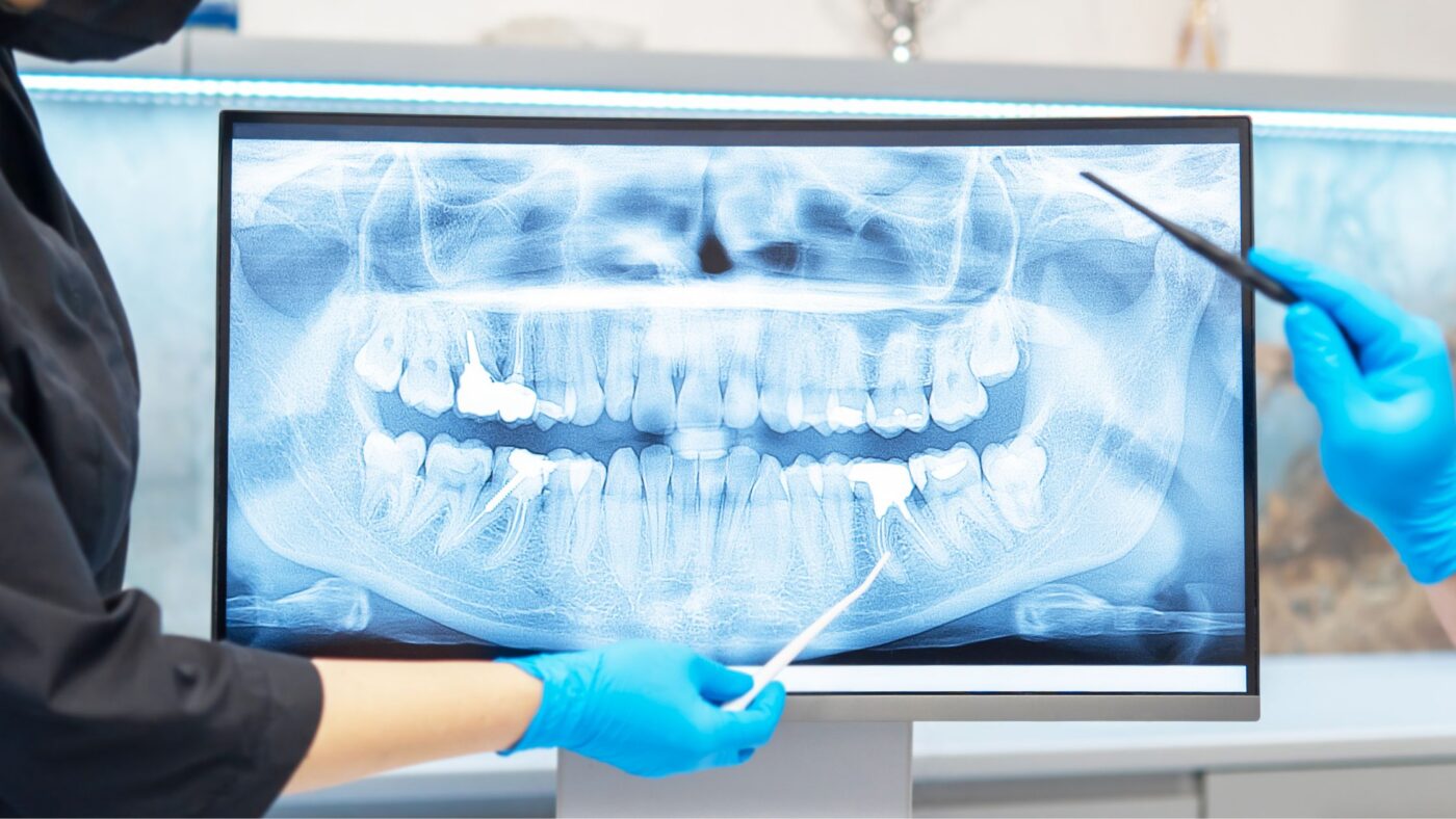 The Advantages of Digital Braces in Northern New Jersey: Modern Solutions for Perfect Smiles