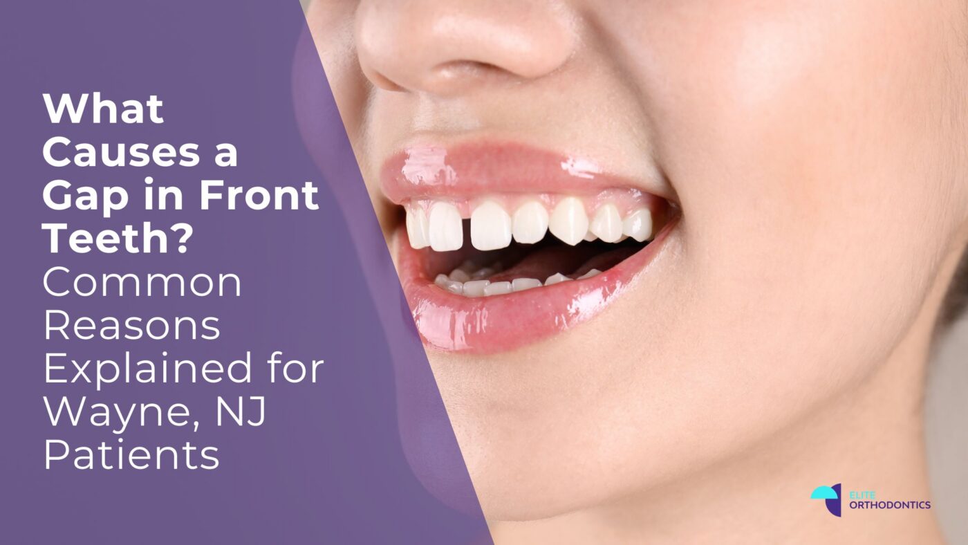 Close-up of a smiling woman showing a small gap between her front teeth, with overlay text reading “What Causes a Gap in Front Teeth? Common Reasons Explained for Wayne, NJ Patients” and Elite Orthodontics logo.