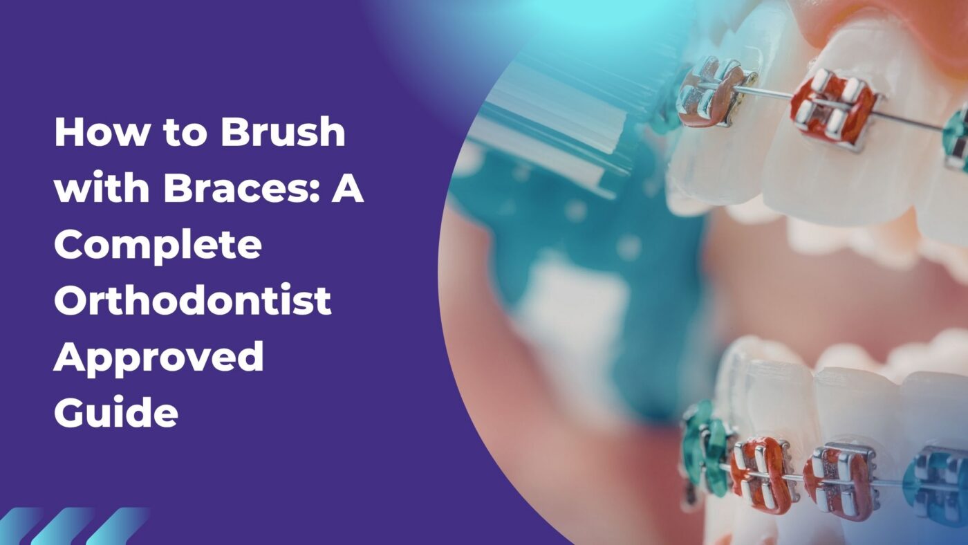 Featured image titled “How to Brush with Braces: A Complete Orthodontist Approved Guide” showing a close-up of teeth with metal braces and a toothbrush cleaning the brackets, set against a purple and teal design background.