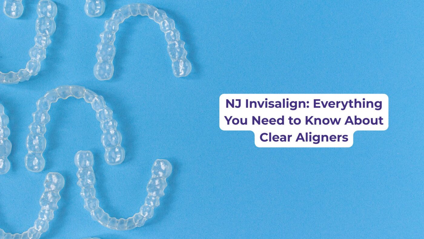 invisalign