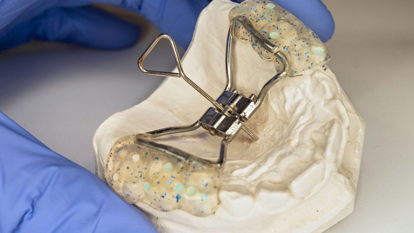 Palate expander orthodontic appliance on a dental model used to widen the upper jaw.