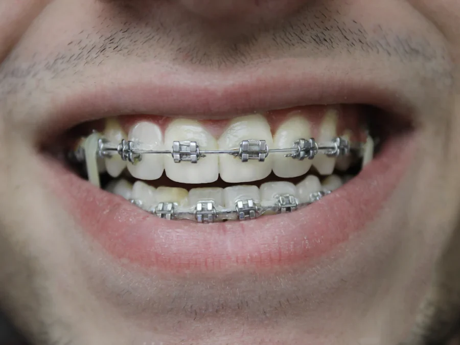 Orthodontics